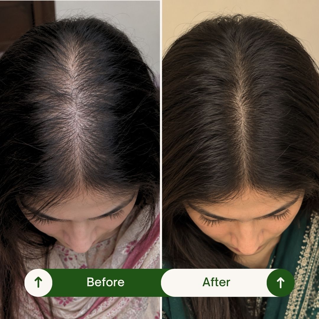 Two overhead hair-parting photographs labelled Before and After.
