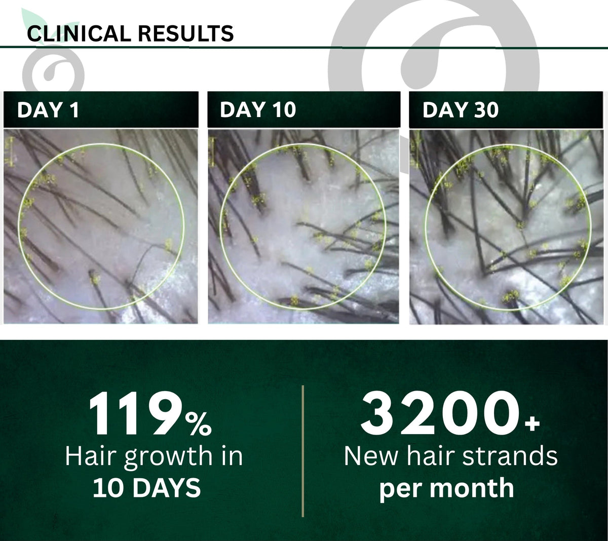 Belo promotional panel with scalp close-ups labelled Day 1, Day 10 and Day 30.